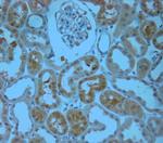 IP3R 1 Antibody in Immunohistochemistry (Paraffin) (IHC (P))