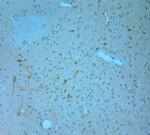 IP3R 1 Antibody in Immunohistochemistry (Paraffin) (IHC (P))