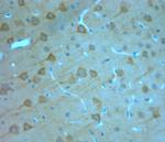 IP3R 1 Antibody in Immunohistochemistry (Paraffin) (IHC (P))