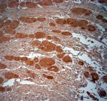 VPS45A Antibody in Immunohistochemistry (Paraffin) (IHC (P))