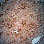 VPS45A Antibody in Immunohistochemistry (Paraffin) (IHC (P))