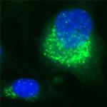 VDP Antibody in Immunocytochemistry (ICC/IF)