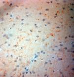 VMAT2 Antibody in Immunohistochemistry (Paraffin) (IHC (P))