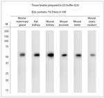 VMAT2 Antibody in Western Blot (WB)