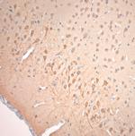 VTI1A Antibody in Immunohistochemistry (Paraffin) (IHC (P))