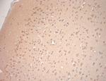 VTI1A Antibody in Immunohistochemistry (Paraffin) (IHC (P))