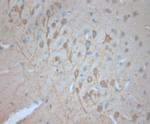 VTI1A Antibody in Immunohistochemistry (Paraffin) (IHC (P))