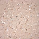 VTI1A Antibody in Immunohistochemistry (Paraffin) (IHC (P))