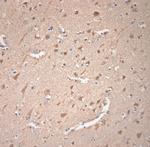 VTI1A Antibody in Immunohistochemistry (Paraffin) (IHC (P))