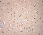 VTI1A Antibody in Immunohistochemistry (Paraffin) (IHC (P))