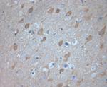 VTI1A Antibody in Immunohistochemistry (Paraffin) (IHC (P))