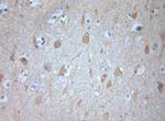 VTI1A Antibody in Immunohistochemistry (Paraffin) (IHC (P))