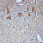 VTI1A Antibody in Immunohistochemistry (Paraffin) (IHC (P))