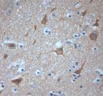 VTI1A Antibody in Immunohistochemistry (Paraffin) (IHC (P))