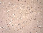 VTI1A Antibody in Immunohistochemistry (Paraffin) (IHC (P))