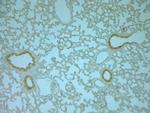 VAMP8 Antibody in Immunohistochemistry (Paraffin) (IHC (P))