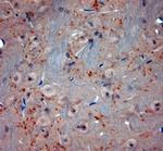 VGluT2 Antibody in Immunohistochemistry (Paraffin) (IHC (P))