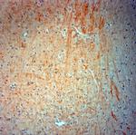 VMAT2 Antibody in Immunohistochemistry (Paraffin) (IHC (P))