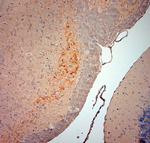 VMAT2 Antibody in Immunohistochemistry (Paraffin) (IHC (P))