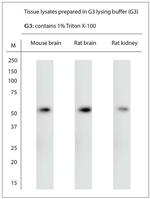 VMAT2 Antibody in Western Blot (WB)