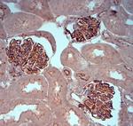 ZO1 Antibody in Immunohistochemistry (Paraffin) (IHC (P))