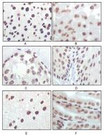 p16INK4a Antibody in Immunohistochemistry (Paraffin) (IHC (P))