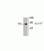 Tyrosine Hydroxylase Antibody in Western Blot (WB)