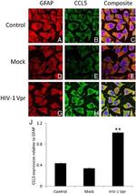 CCL5 (RANTES) Antibody in Immunocytochemistry (ICC/IF)