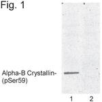 Phospho-CRYAB (Ser59) Antibody in Western Blot (WB)