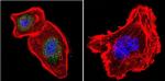 NFATC4 Antibody in Immunocytochemistry (ICC/IF)