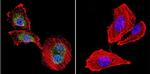 NFATC4 Antibody in Immunocytochemistry (ICC/IF)