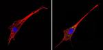 alpha-1a Adrenergic Receptor Antibody in Immunocytochemistry (ICC/IF)