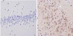 alpha-1a Adrenergic Receptor Antibody in Immunohistochemistry (Paraffin) (IHC (P))