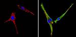 COPII Antibody in Immunocytochemistry (ICC/IF)