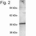 PICK1 Antibody in Western Blot (WB)