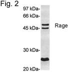 RAGE Antibody in Western Blot (WB)