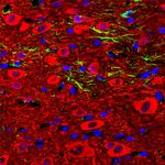 NSE Antibody in Immunocytochemistry (ICC/IF)