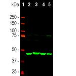 NSE Antibody in Western Blot (WB)