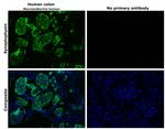 Synaptophysin Antibody in Immunohistochemistry (Paraffin) (IHC (P))