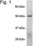 ANGPTL4 Antibody in Western Blot (WB)