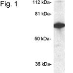 CPEB1 Antibody in Western Blot (WB)