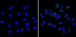 CPEB1 Antibody in Immunocytochemistry (ICC/IF)