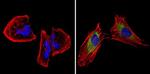 CPEB1 Antibody in Immunocytochemistry (ICC/IF)