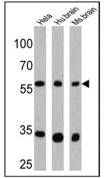 CPEB1 Antibody in Western Blot (WB)