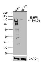 EGFR Antibody in Western Blot (WB)