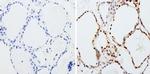 PAX8 Antibody in Immunohistochemistry (Paraffin) (IHC (P))