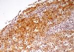 NTHL1 Antibody in Immunohistochemistry (Paraffin) (IHC (P))