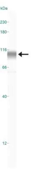 HIF-2 alpha Antibody in Western Blot (WB)