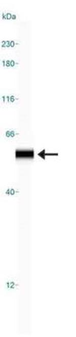 PHD2 Antibody in Western Blot (WB)