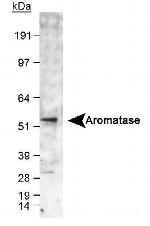 Aromatase Antibody in Western Blot (WB)